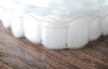 Braces Plastic Cutting Effect