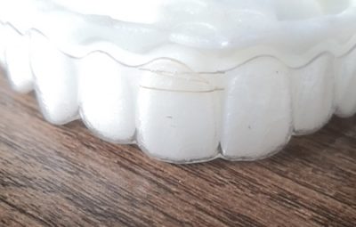 Braces Plastic Cutting Effect